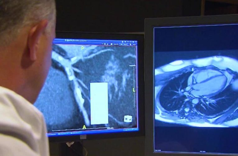 This makes you more vulnerable to Covid-19