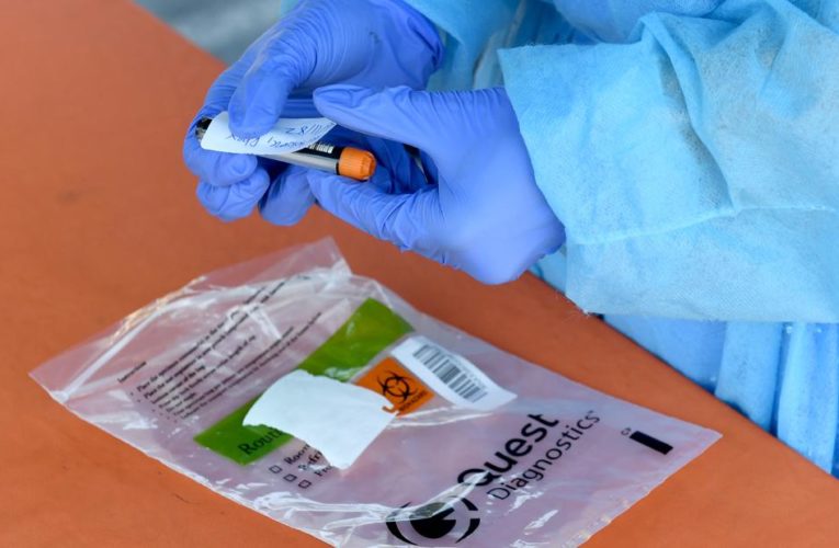 New guidelines that raise the bar on who should get tested came as a result of pressure from the upper ranks of the Trump administration, an official tells CNN