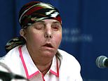 New Hampshire woman, 52, becomes first American to get a SECOND face transplant