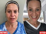 Can the facial the A-listers swear by really knock years off you with just one 90-minute treatment?