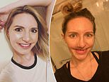 Woman was left TOOTHLESS after her toothache turned out to be cancer