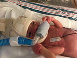 Premature baby Lily has first birthday in UK following five-month battle in US