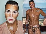 Model, 37, with rare skin condition vitiligo says strangers thought condition was contagious