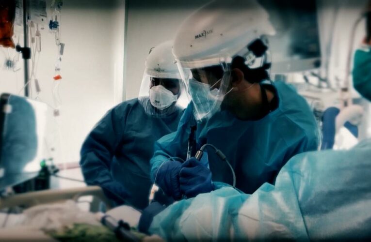 ‘Bad brain fog’: Patients who had Covid-19 reveal phenomenon