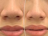 How to transform your nose without going under the knife