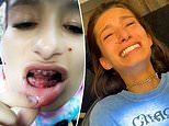 Woman who had ALL her teeth pulled out gets $30,000 smile makeover