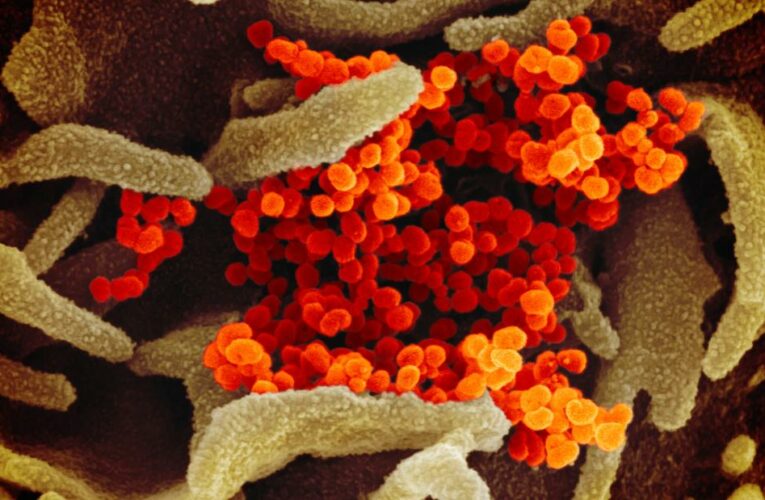 Covid-19 infection rates in the US are still too high, Fauci says