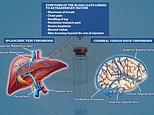 Covid-19 UK: What should I do if I’ve had the AstraZeneca jab?