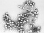 Cancer-killing treatment using a common cold virus offers hope to patients with inoperable tumors 