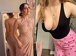 Woman, 23, has a rare condition which means she only grew one breast