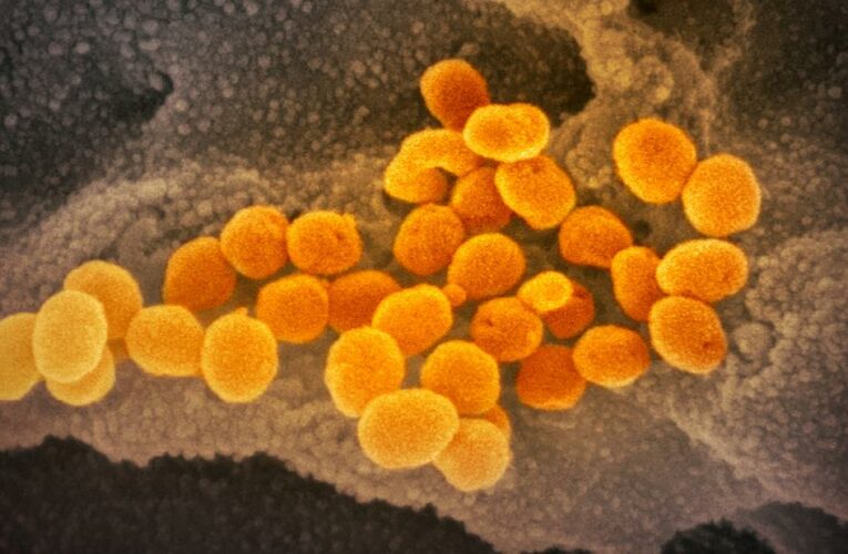 The latest on the Covid-19 pandemic in the US