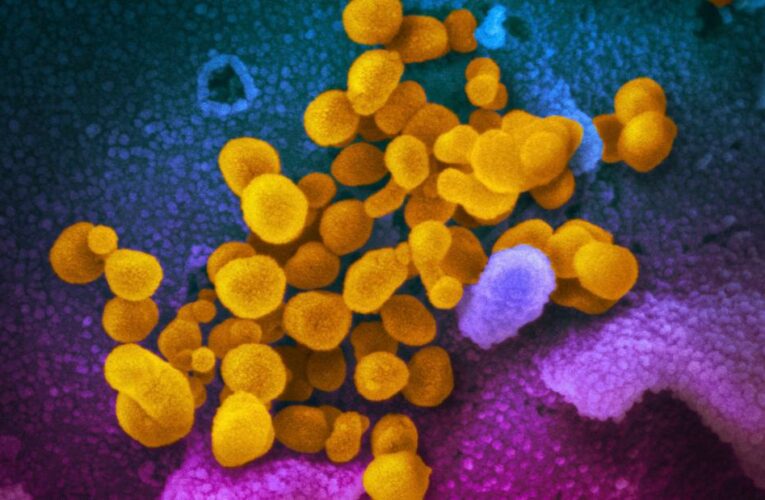 Scientist says early Covid samples were deleted from NIH database