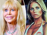 Britt Ekland says toll of her cosmetic injections should be bitter lesson for Instagram stars