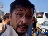 Afghanistan evacuation: Man beaten bloody by Taliban as airlift nears its end
