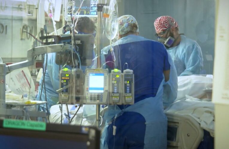 This is what the process of going on a ventilator looks like