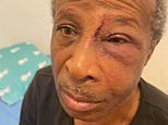 Police watchdog launches probe over arrest of black man, 70, who ‘suffered fractured eye socket’