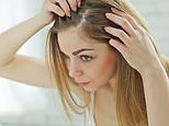 What does YOUR dandruff say about your health?