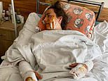 Wife, 31, injured as brother and friend killed in honeymoon bloodbath from WW1 bomb in Ukraine