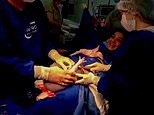Incredible moment newborn twin PUNCHES her way out of amniotic sac moments after sister delivered