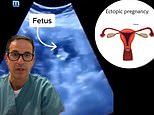 Canadian woman had a fetus growing in her LIVER in a highly RARE ectopic pregnancy