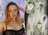 Mortified girlfriend ends up in A&E with  sex toy stuck in her backside