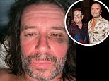 Alan Carr’s marriage to Paul Drayton never recovered after black eye photo