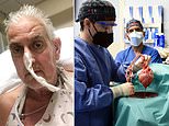 US surgeons transplant a PIG heart into a human in world first