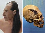 Metal plate attached to 2,000 year-old Peruvian warrior’s skull may be oldest evidence of SURGERY