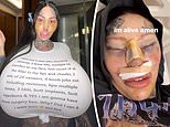 Surgery-addicted social media star unveils her ‘Barbie nose’ and ‘cat eyes’