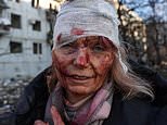 Putin’s innocent victims: Bloodied Ukrainians stagger through rubble in shocking images