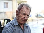 Putin’s innocent victims: Bloodied Ukrainians stagger through rubble in shocking images