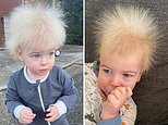 Little boy has ultra-rare ‘uncontrollable hair syndrome’ which makes strands stand up on end