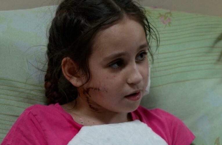 Ukrainian family: Child shot in face by Russian soldier