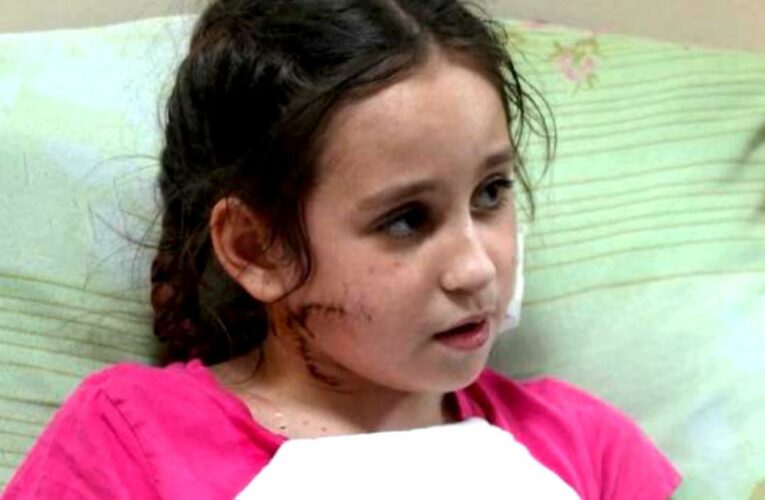 Ukrainian family: Child shot in face by Russian soldier