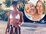 Mum-of-two reveals why ‘getting a little bit sunburned’ is a real problem
