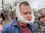 Bloodied face of pilot who was praised by Vladimir Putin for Syrian sorties is beamed around world