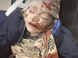 Ukraine war: Russian advance ‘slows significantly’ as children hurt in strikes