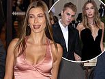 Hailey Bieber is hospitalized for a brain-related ‘medical emergency’