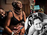 Award-winning photos capture agony and ecstasy of childbirth