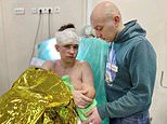Seriously injured Ukrainian woman breastfeeds baby daughter after shielding her from blast