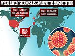 US is hit by mysterious spate of severe hepatitis cases in children