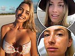 Elayna Carausu shares the horror skin damage to her face after sailing full-time