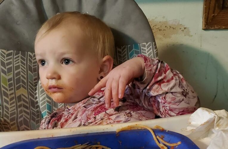Children are suddenly coming down with hepatitis. Here’s what happened to this 2-year-old.