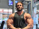 Australian ‘Mr Universe’ Calum von Moger in coma after falling through second storey window