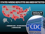 CDC 71 new cases of mysterious pediatric hepatitis