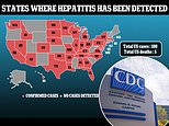 CDC 71 new cases of mysterious pediatric hepatitis