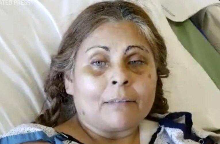 Woman who survived Pennsylvania factory explosion said falling into vat of liquid chocolate saved her life